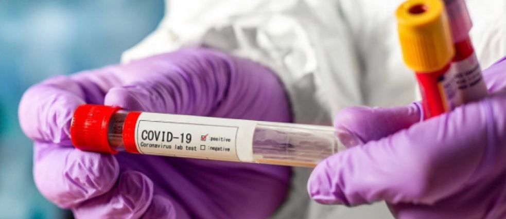 Shtohen klinikat ku mund të bëhet testimi për CoVid-19, “Intermedica” i vetmi laborator që e ofron me metoda nga dy kompani të ndryshme