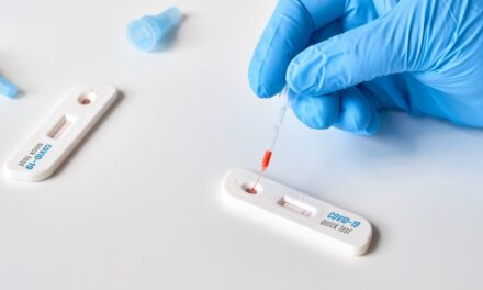 Edhe Turqia kërkon testin PCR, ose 7 ditë karantinë