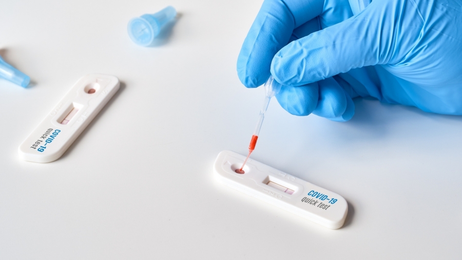 Edhe Turqia kërkon testin PCR, ose 7 ditë karantinë
