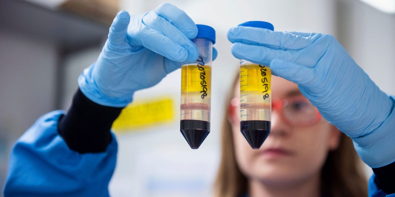 Shkencëtarët në Britani testojnë përzierjen e vaksinave AstraZeneca e Pfizer