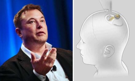 Elon Musk do të nisë transplantimin e çipeve në trurin e njeriut vitin e ardhshëm